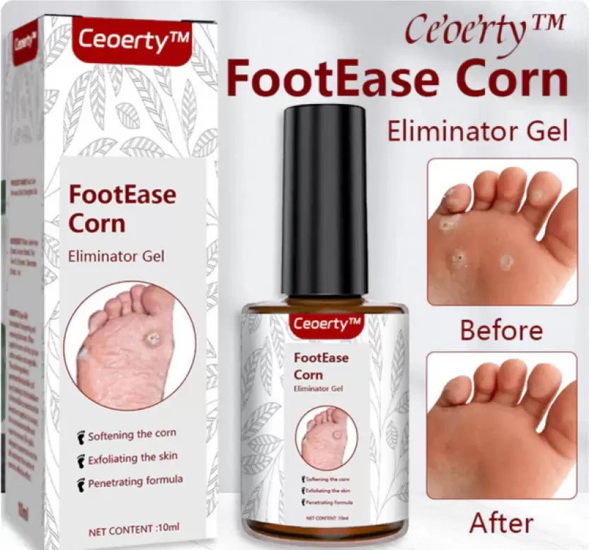 Feet Corn Removal Serum 30ml ( Pack Of 1 )